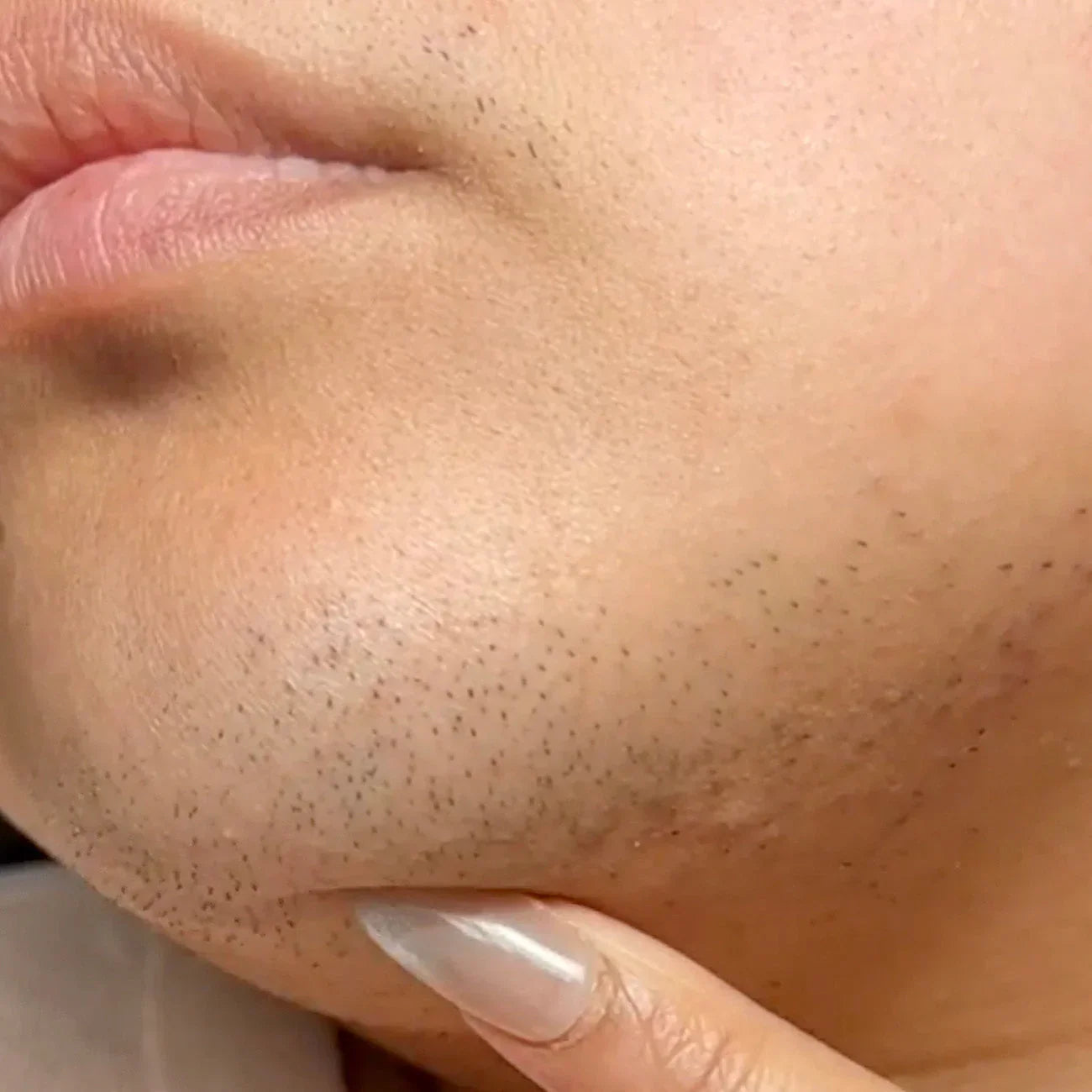 Ağır saç büyümesi: iki neden