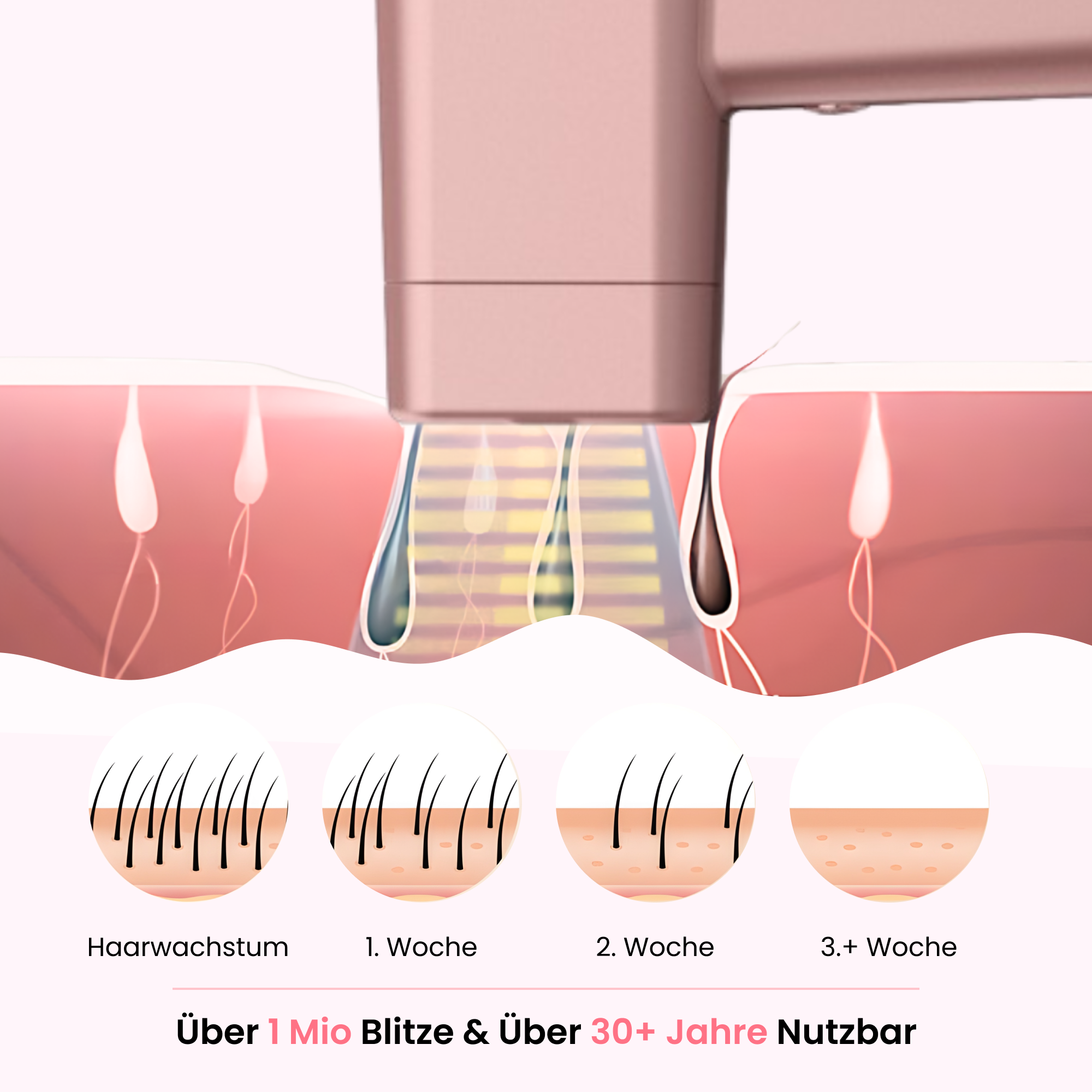 حزمة shiny IPL 3.0 Pro