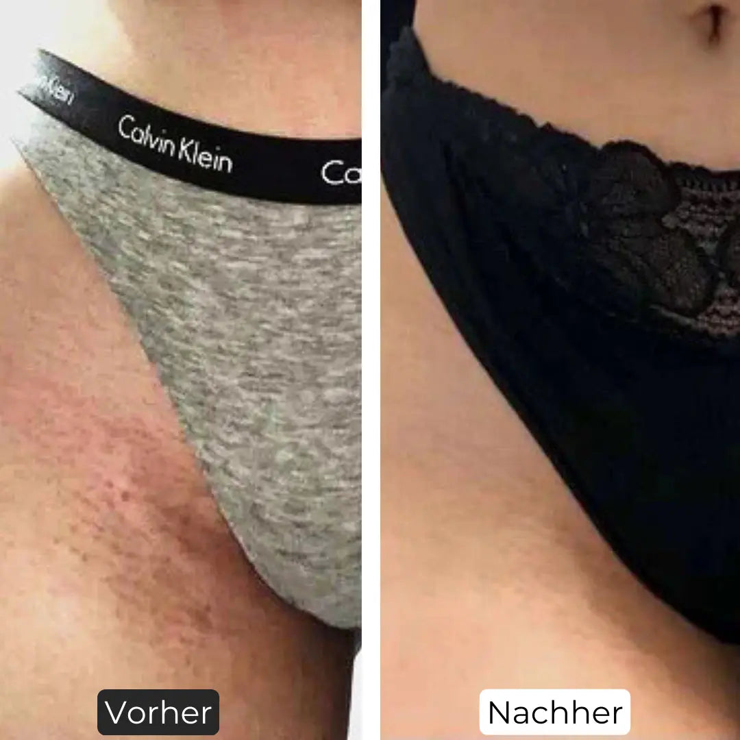 Premium Haarfrei Bundle Shinie