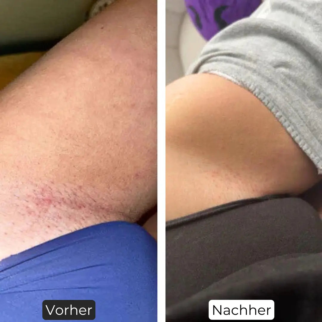 Premium Haarfrei Bundle Shinie