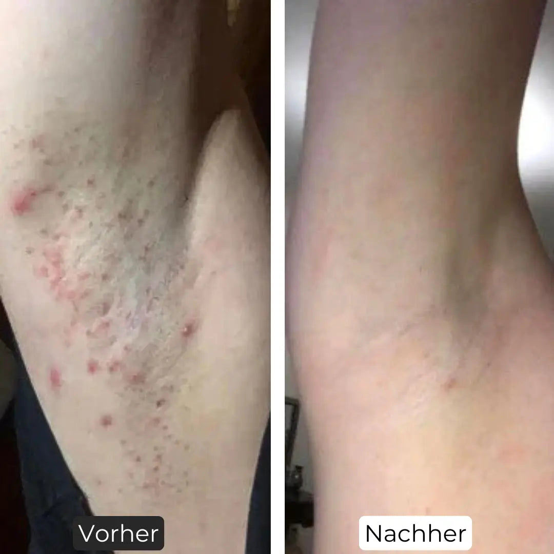 Premium Haarfrei Bundle Shinie