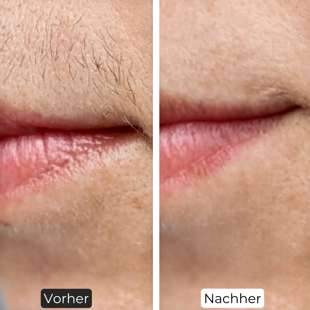 باقة ممتازة خالية من الشعر