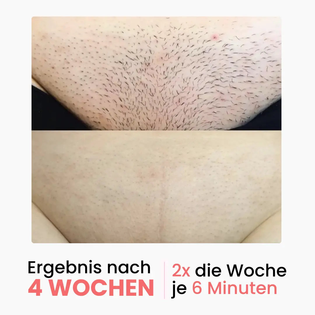 Zestaw Premium do depilacji Shinie