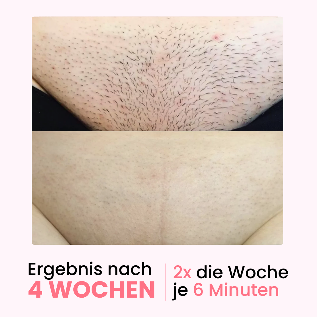 Herbst Premium Haarfrei Bundle