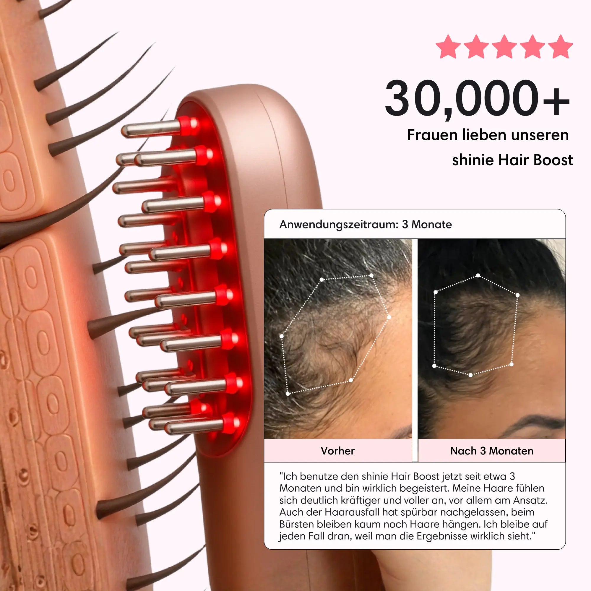 HairBoost Starter Kit Shinie