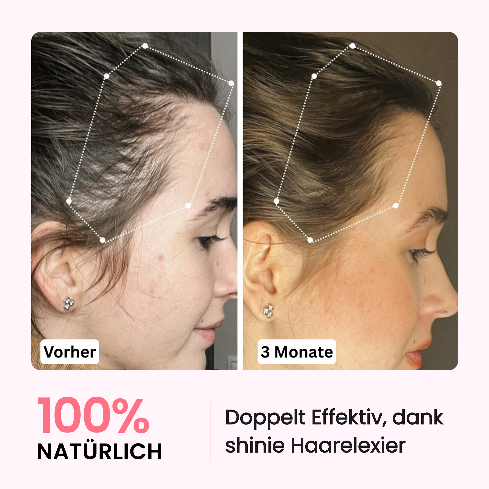 NEU: Premium HairBoost Bundle