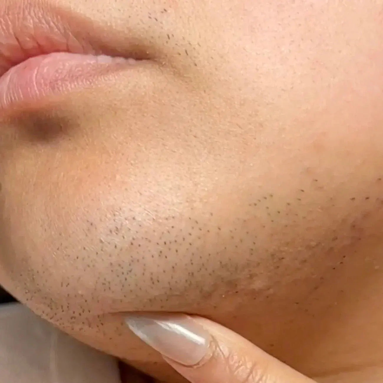 Intensywny porost włosów: dwie przyczyny