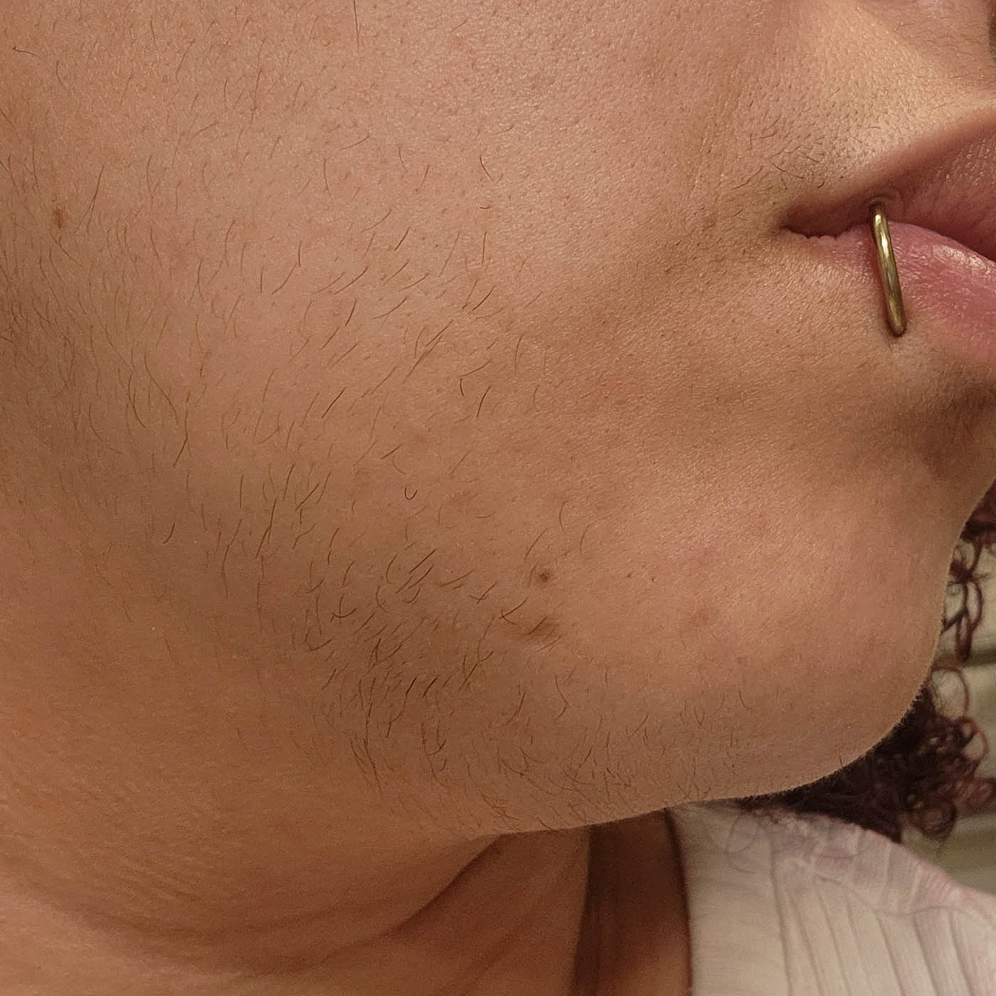 PCOS & Haarwuchs: Was tun?