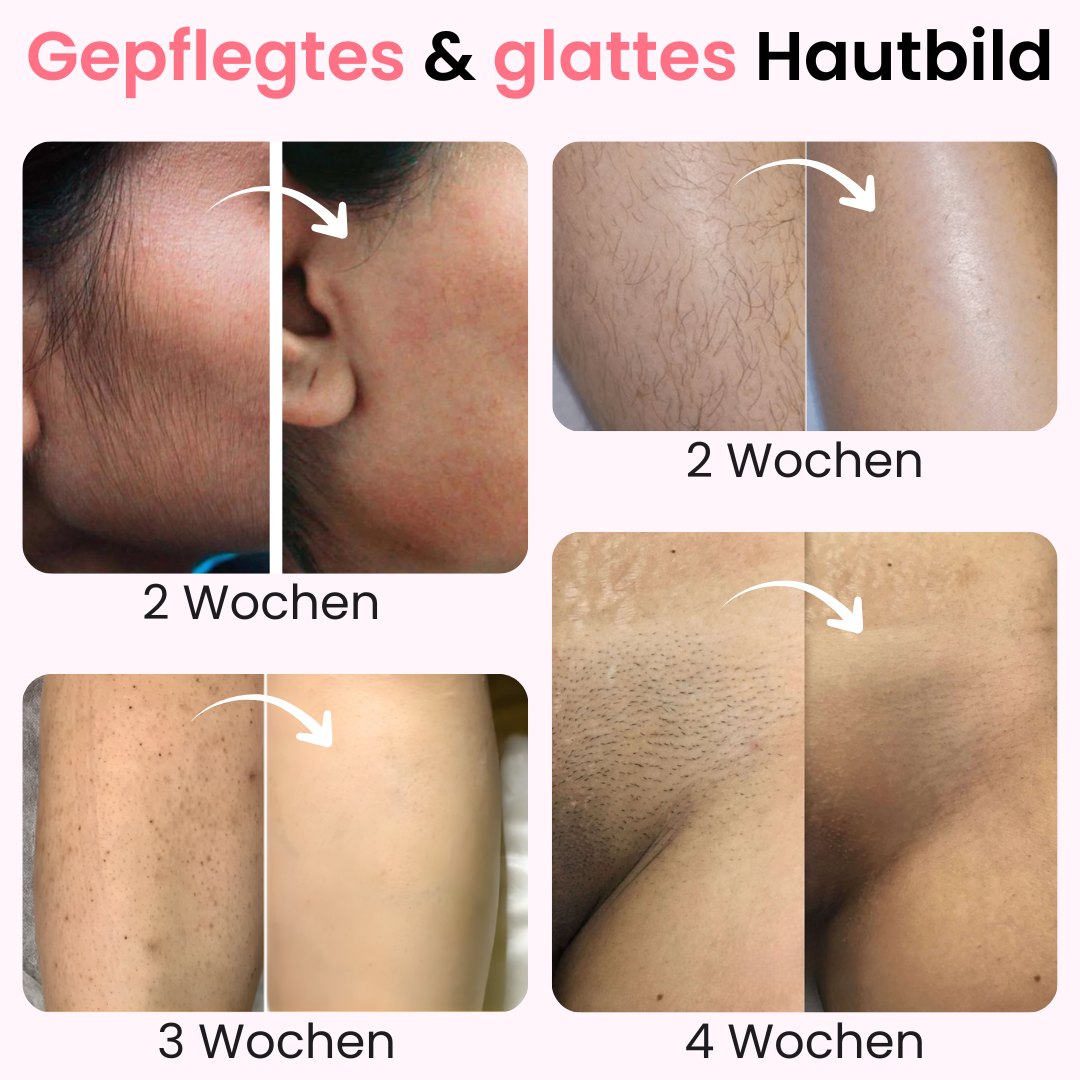Herbst Premium Haarfrei Bundle