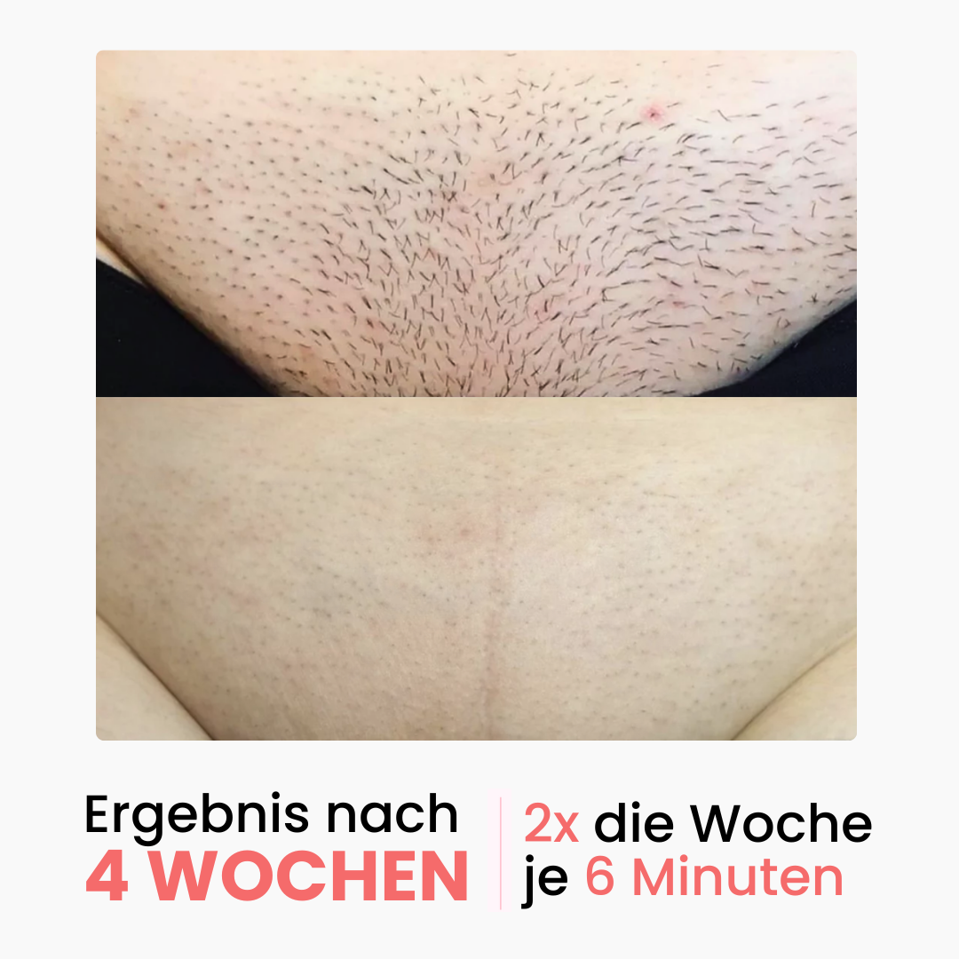 Premium Haarfrei Bundle