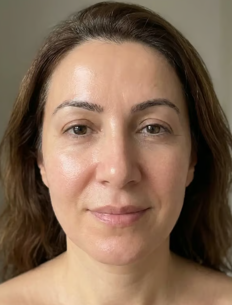 Aylin nachher